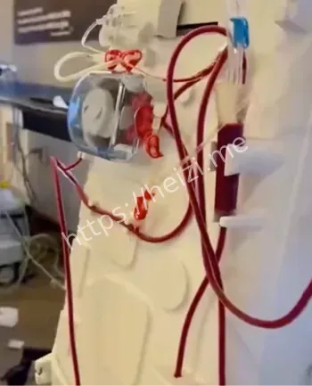 急性肾衰竭ICU抢救