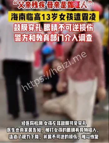 13岁女孩左耳鼓膜穿孔