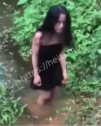 13岁女孩左耳鼓膜穿孔