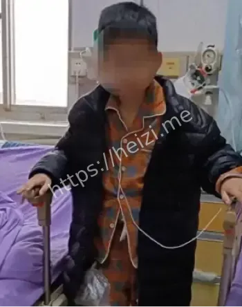 山东菏泽10岁男孩腹痛手术切除器官