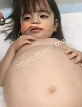 性早熟儿童怀孕医学黑幕