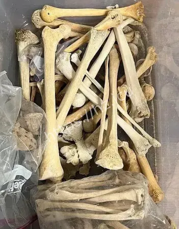 盗卖遗骸人皮制书